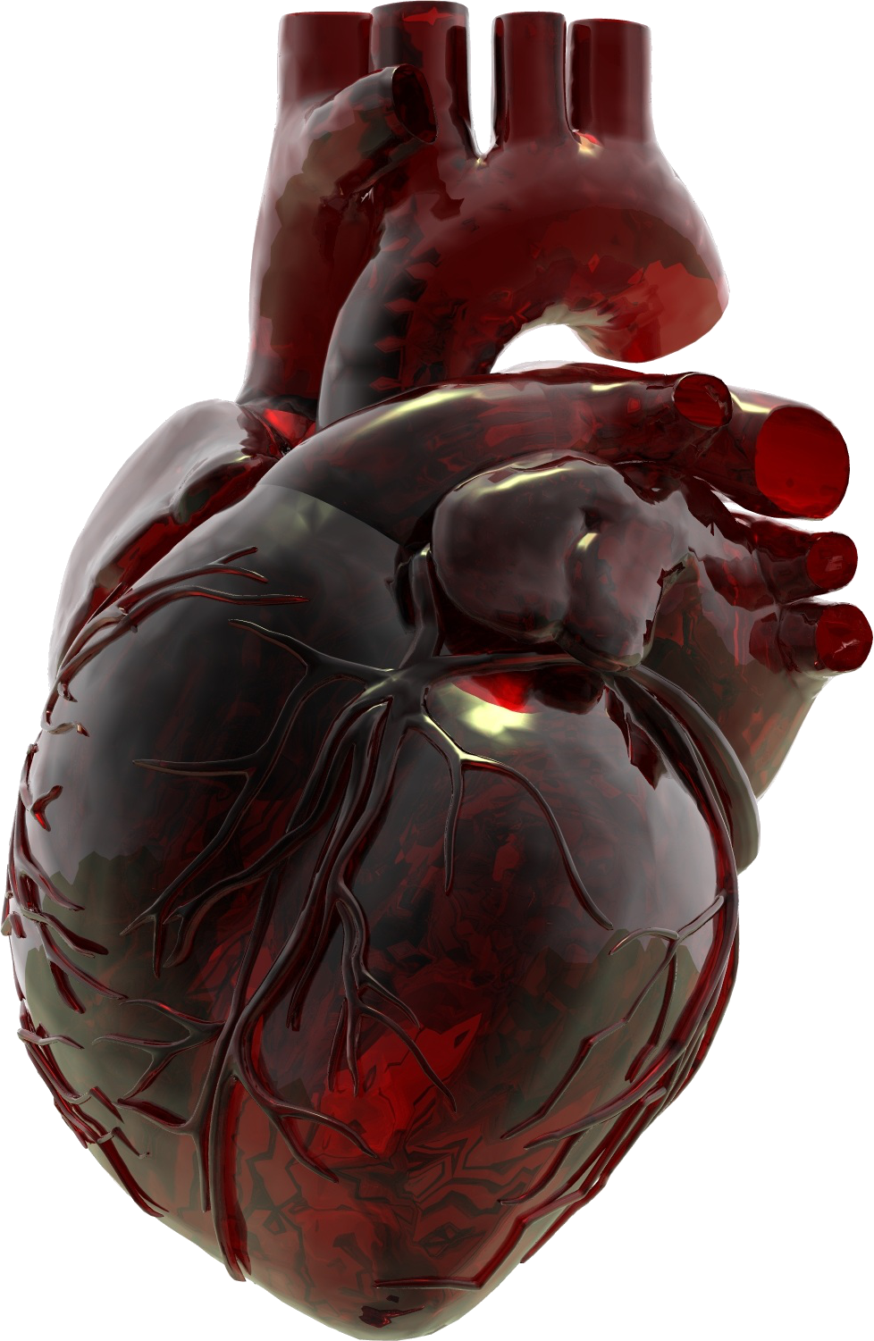 Анатомия заболеваний сердца