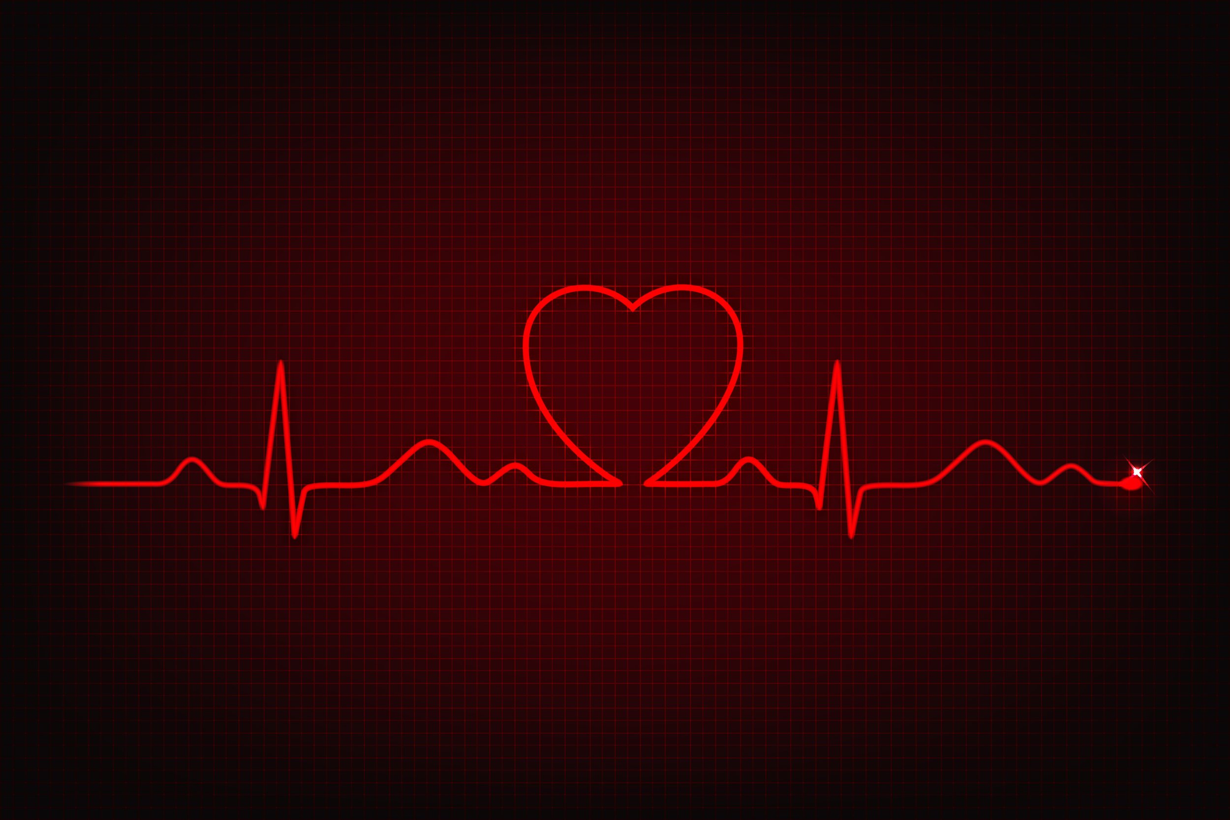 Сердцебиение остановилось. Кардиограмма. Пульс. Пульс сердца. Кардиограмма серлце.