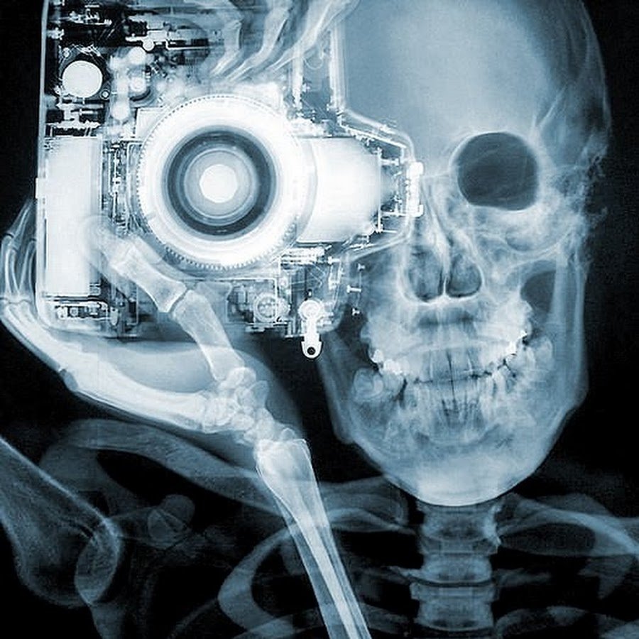 Необычный рентгеновский снимок
