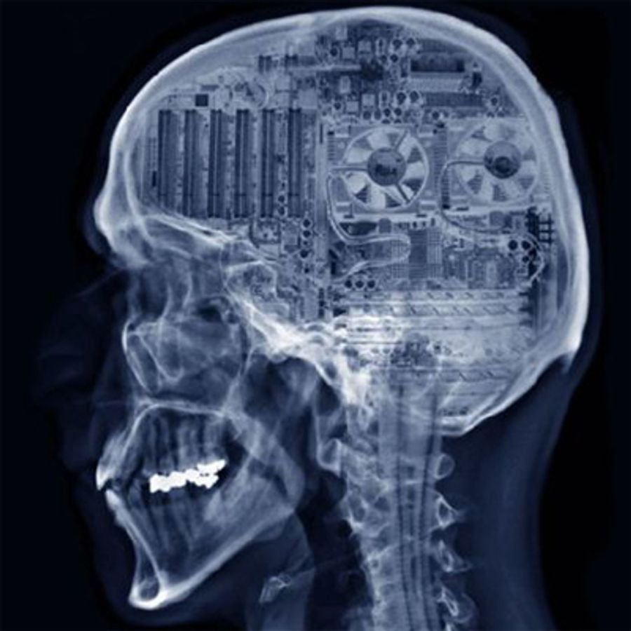 Рентгеновский снимок мозга