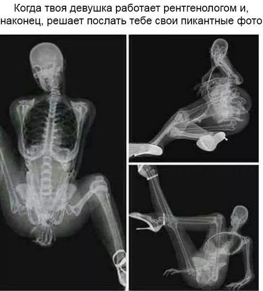 Прикольный рентгеновский снимок