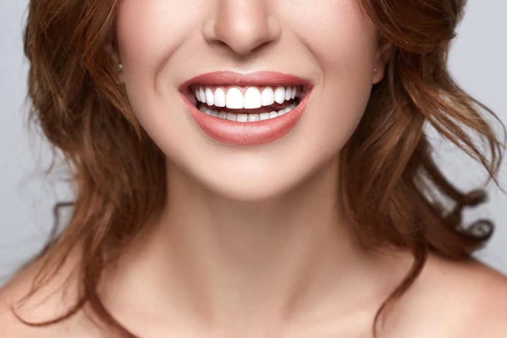 Красивая улыбка зубы