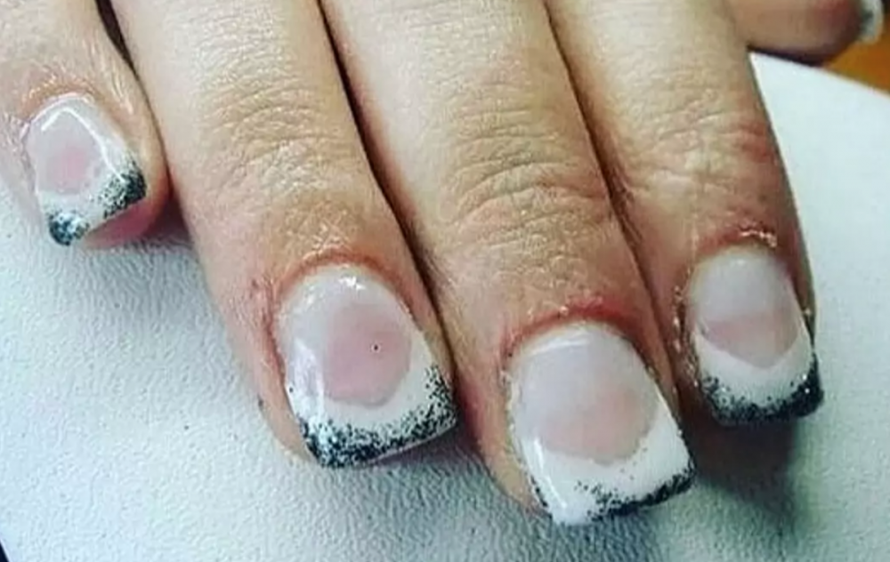 Самые ужасные ногти