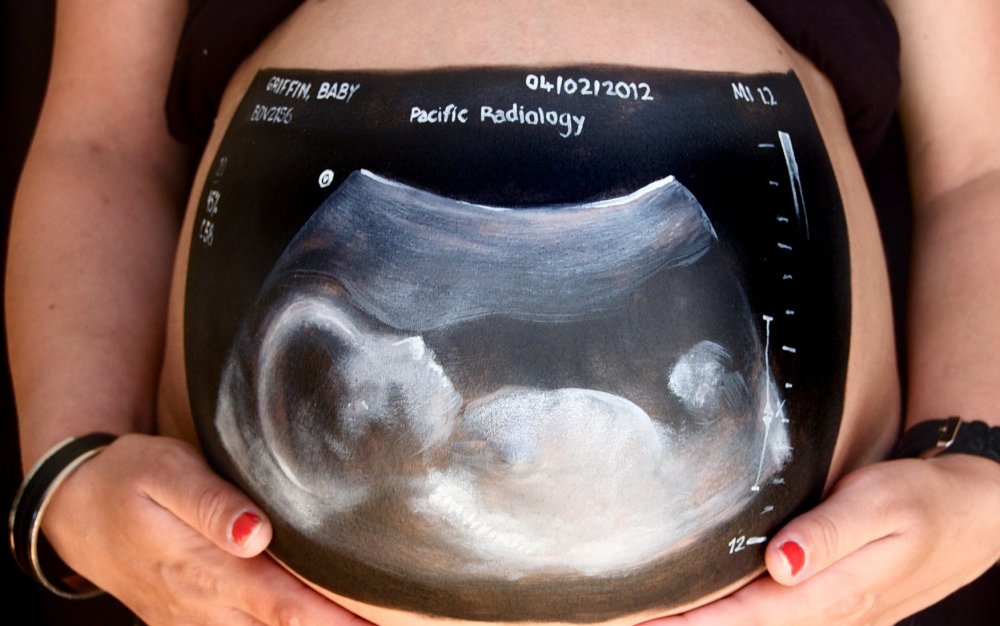 Рисунки на животе у беременных УЗИ