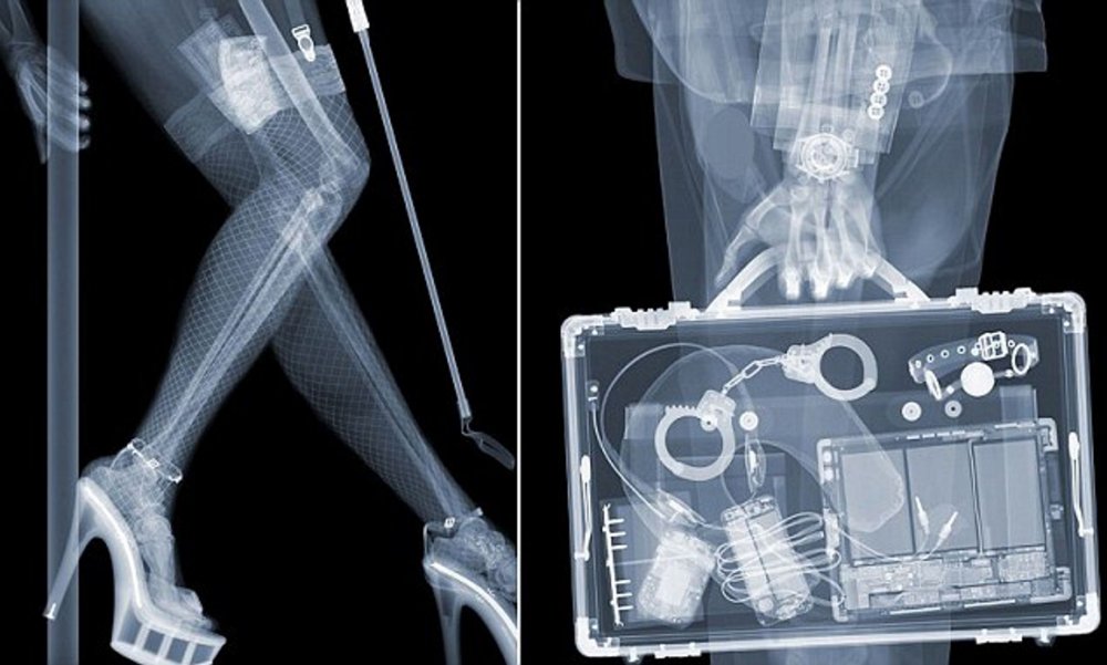 Прикол снимок рентгена коленного сустава