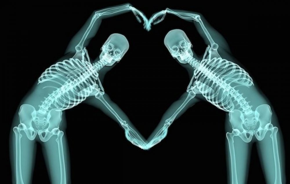 Красивые рентгеновские снимки