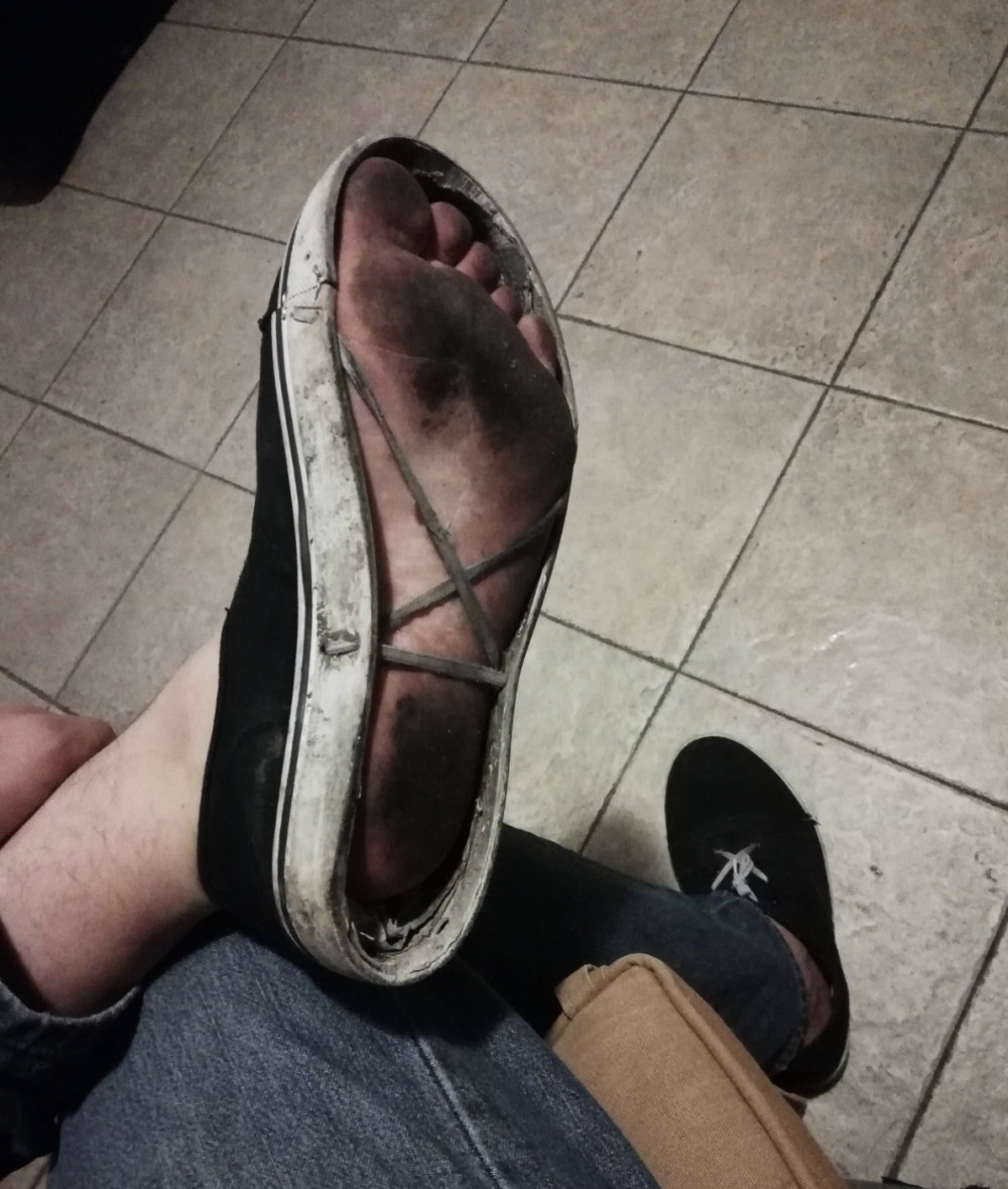 Порванные туфли