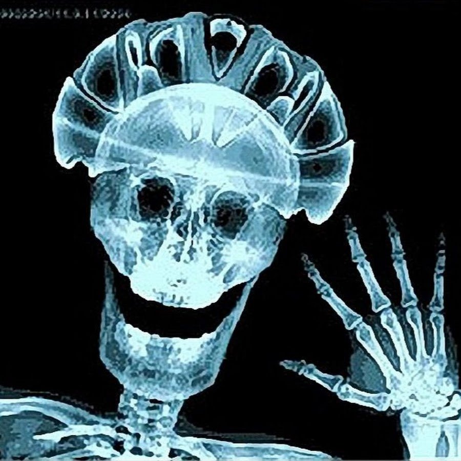 Смешной рентгеновский снимок