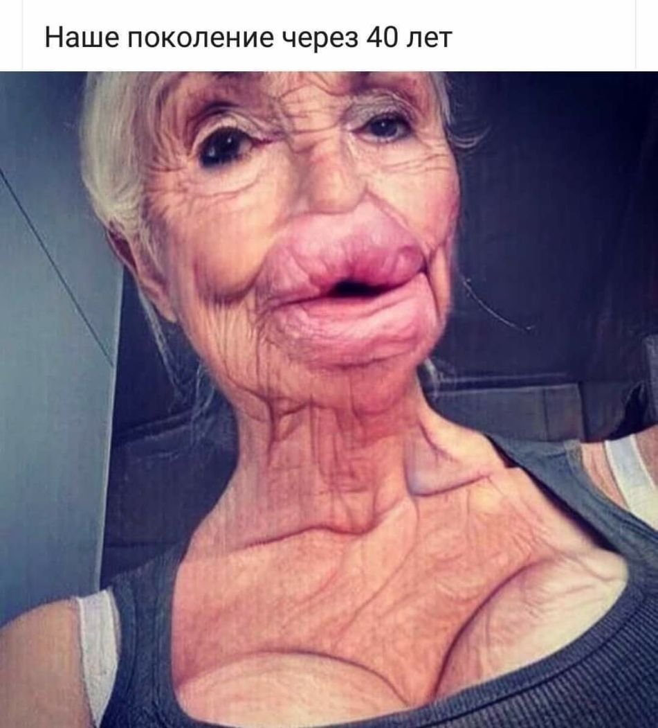 Бабушка с накаченными губами