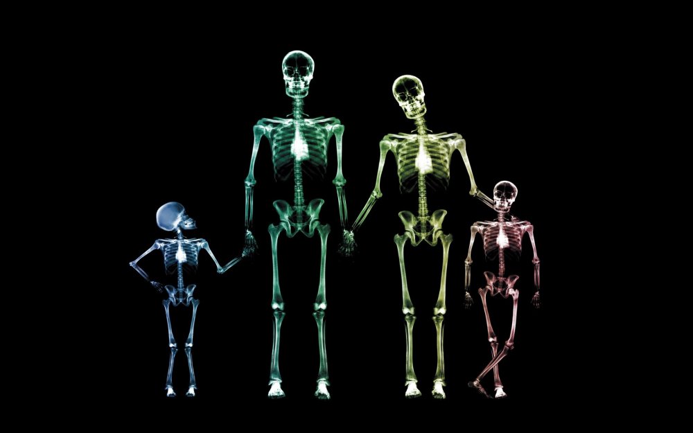 Рентген человека прикол