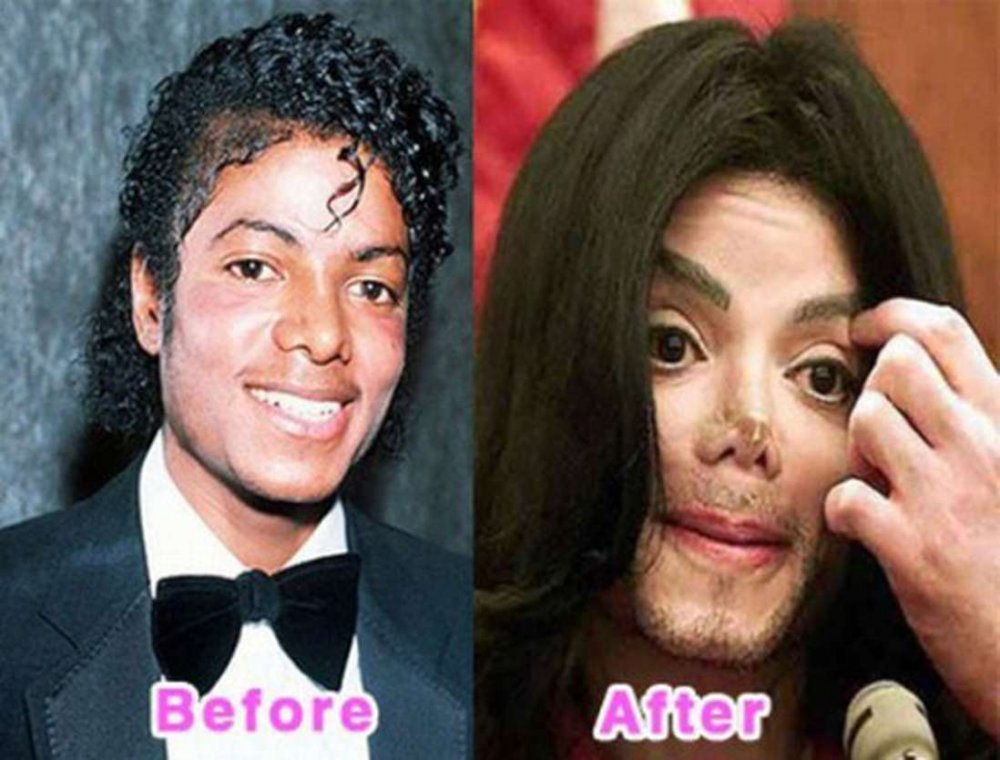 Майкл Джексон до и после операции