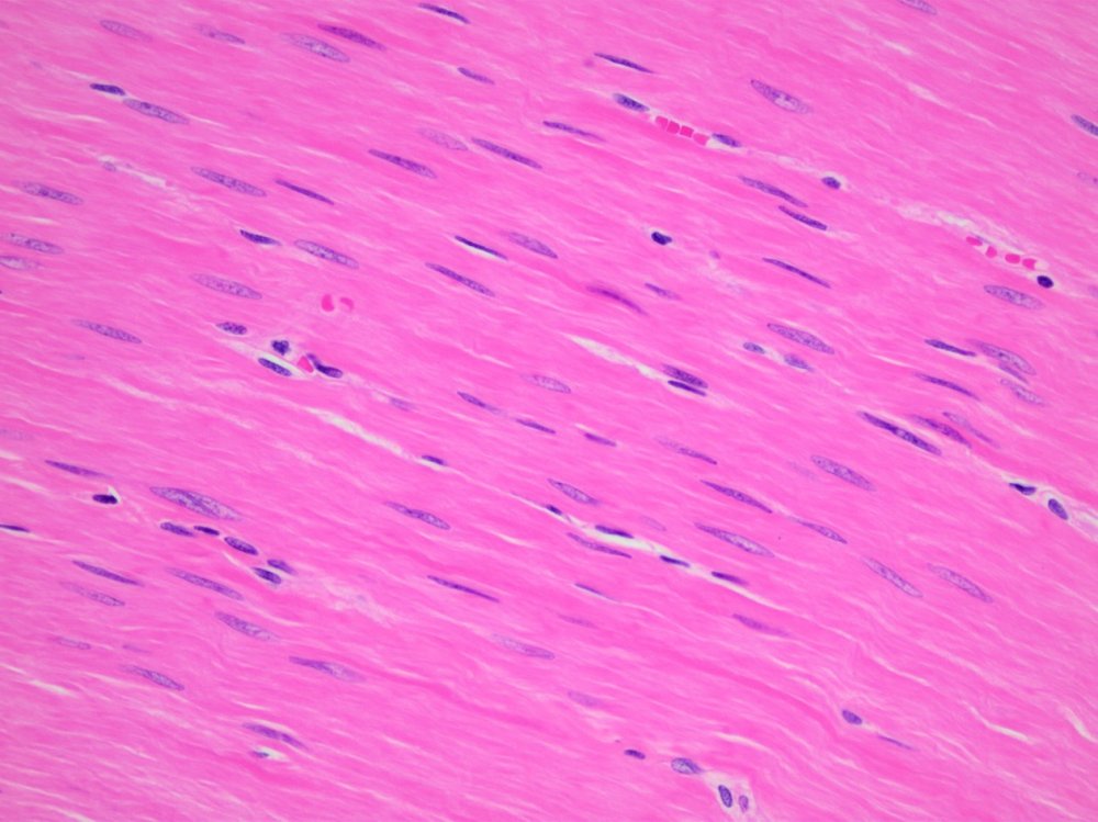 Гладкая мышечная клетка гистология