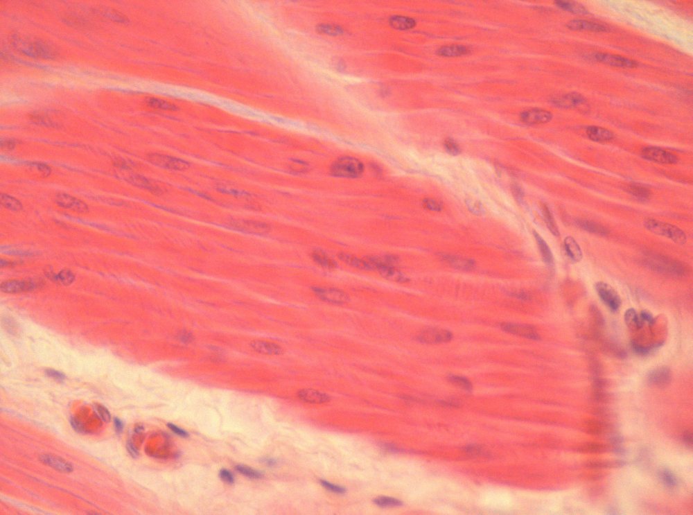 Веретеновидные клетки мышечной ткани
