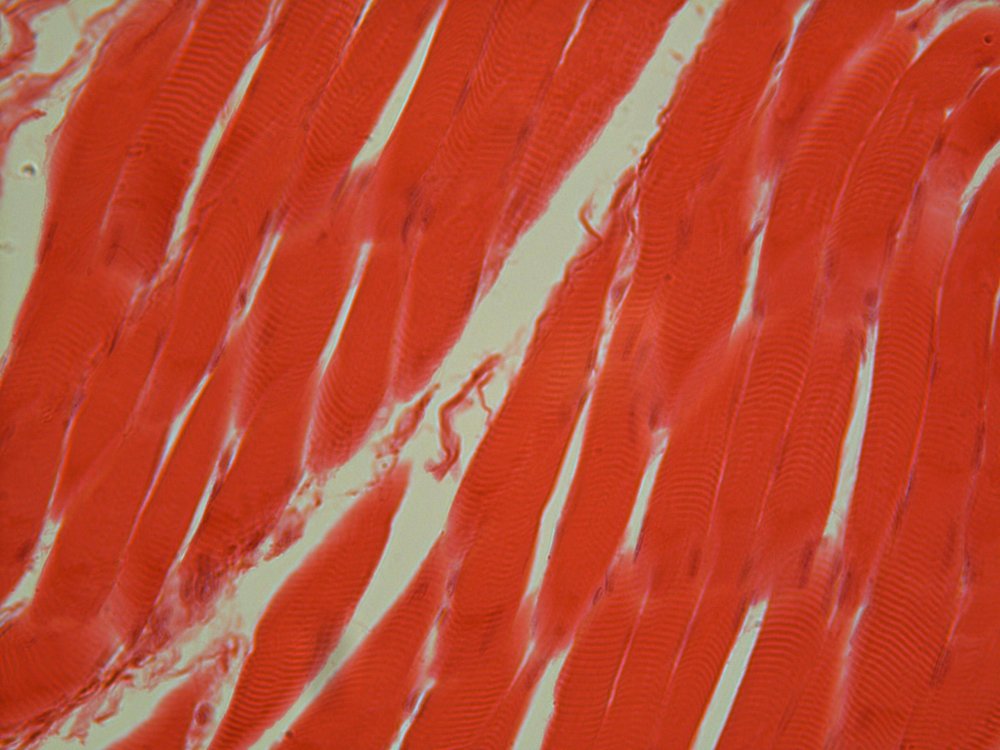 Поперечно-полосатая мышечная ткань. 1 Мышечные клетки