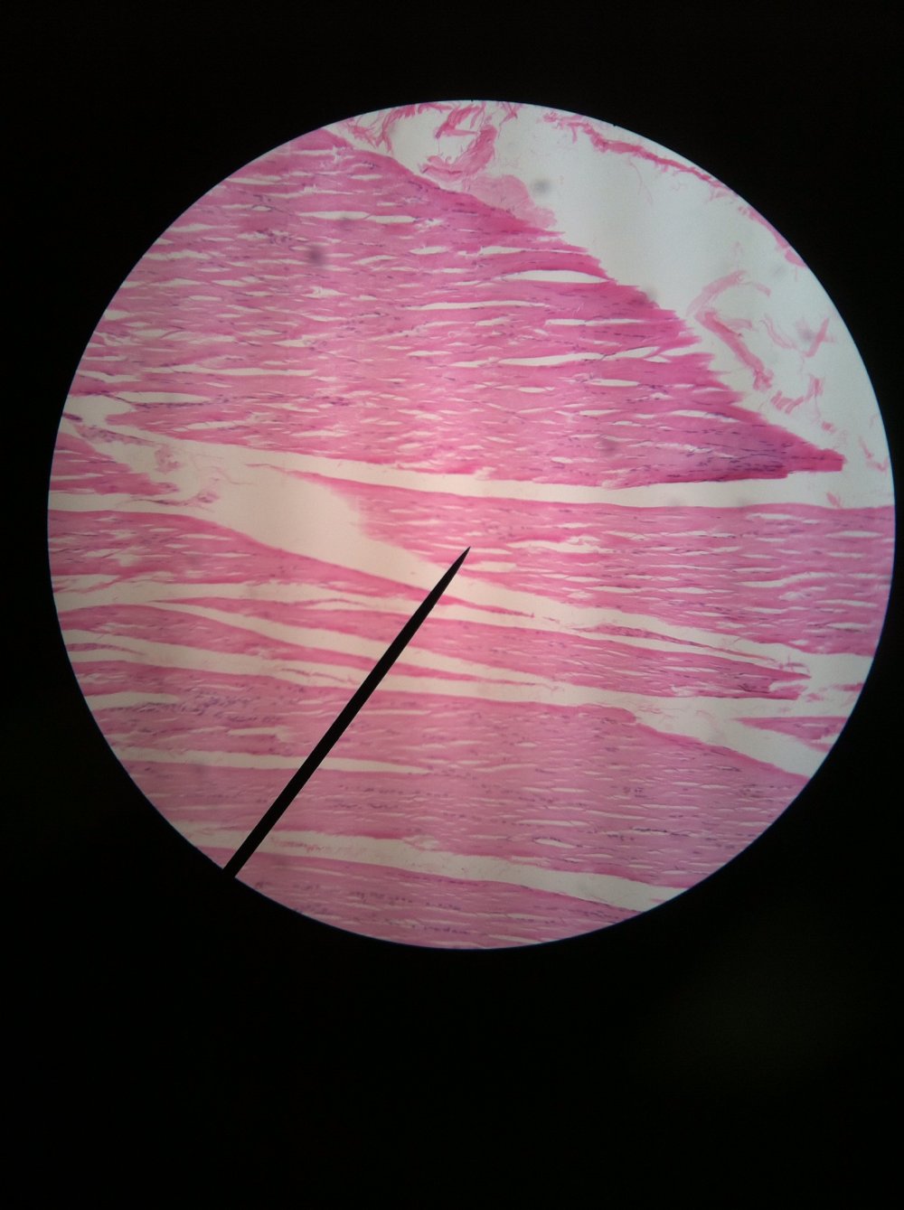 Мышцы под микроскопом