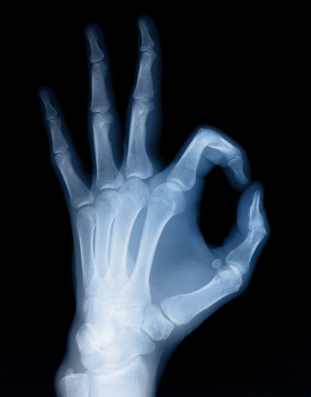 Рентгеновское излучение рентген