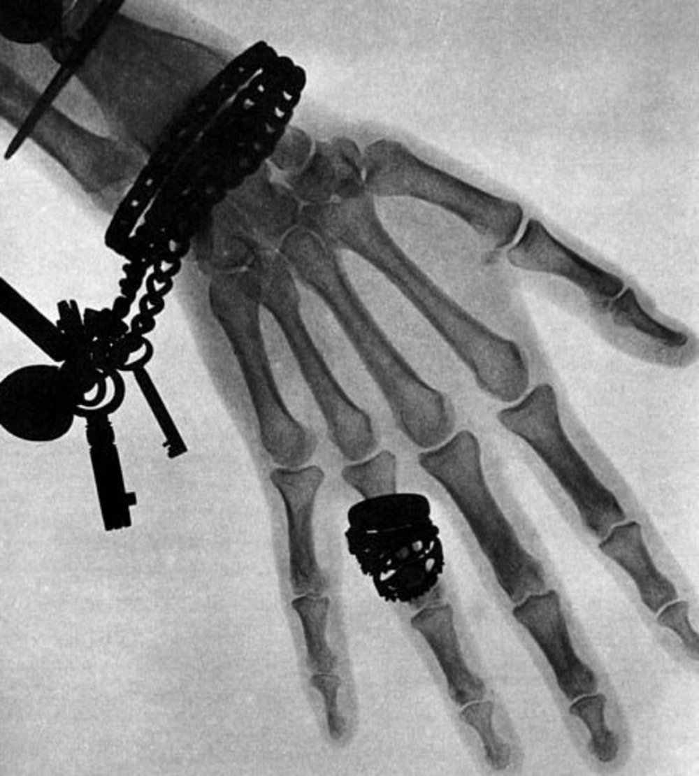 Вильгельм Конрад рентген снимок руки