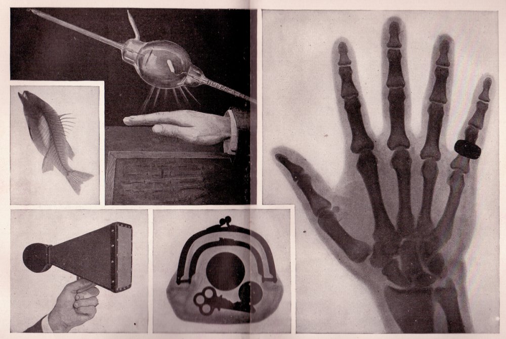 Рентген открытие рентгеновских лучей