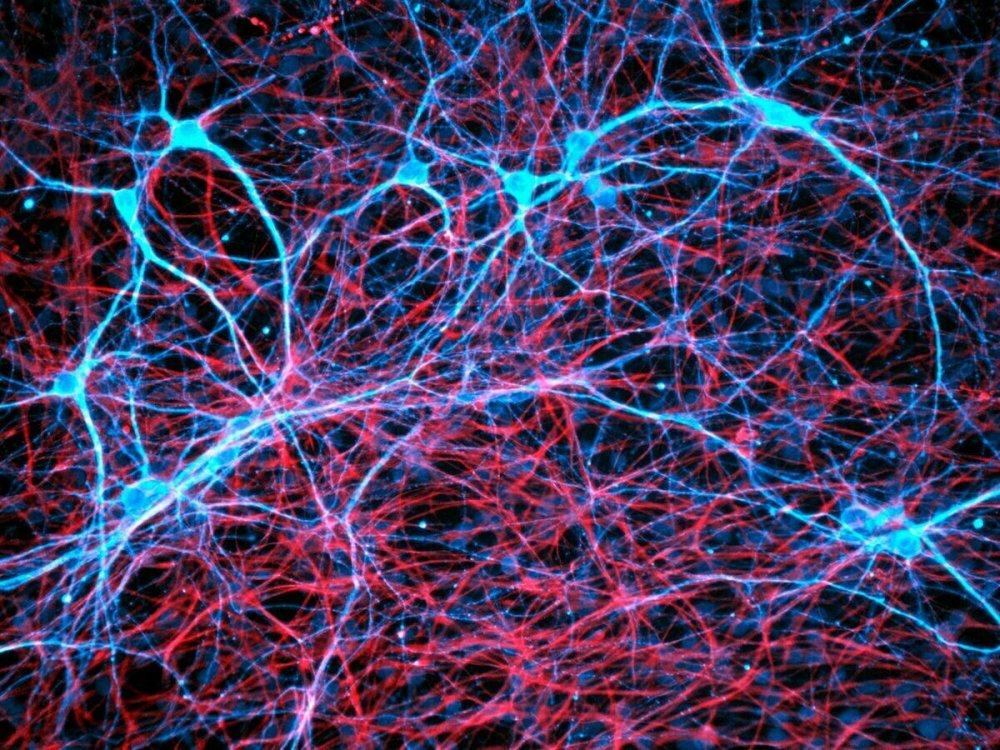 Нейрон нейросеть